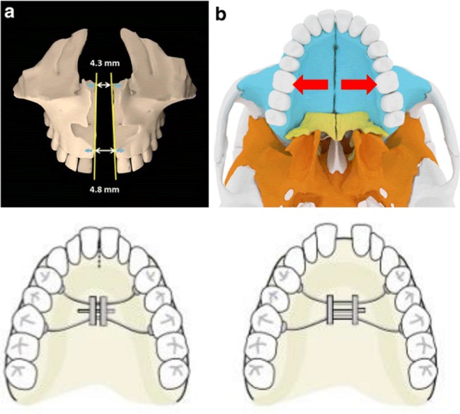 2444 7986 orl 15 04 337 fig2