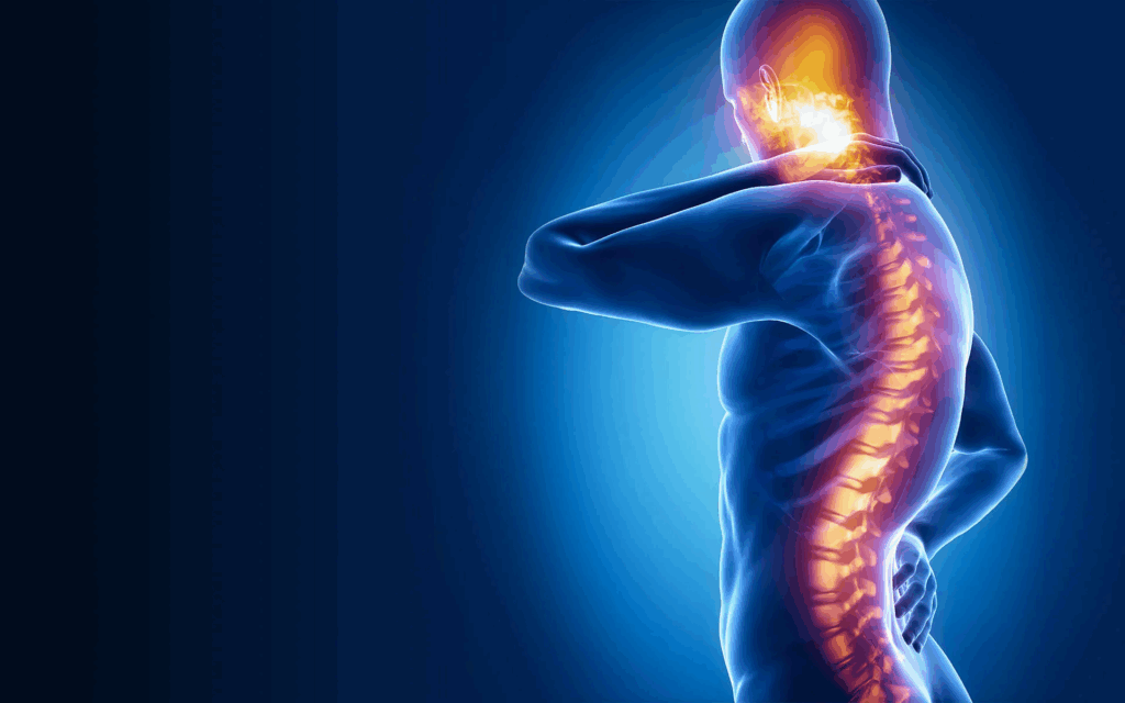 spinal cord injury