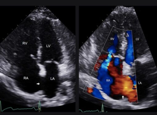 cortocircuito 510x374 1