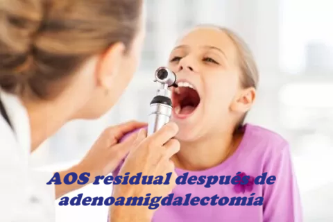 Amigdalectomia en ninos min 480x320