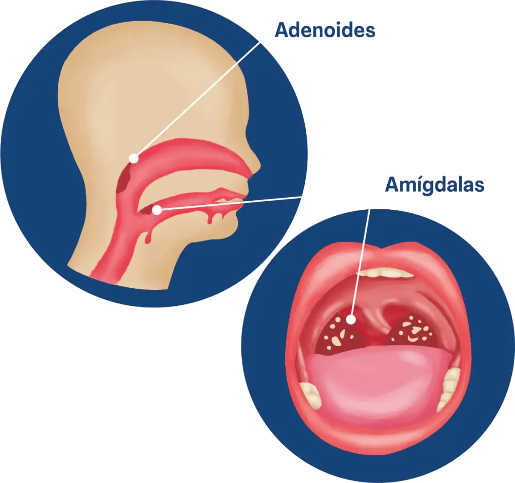 Cirugia de Otorrinolaringologia 1024x960