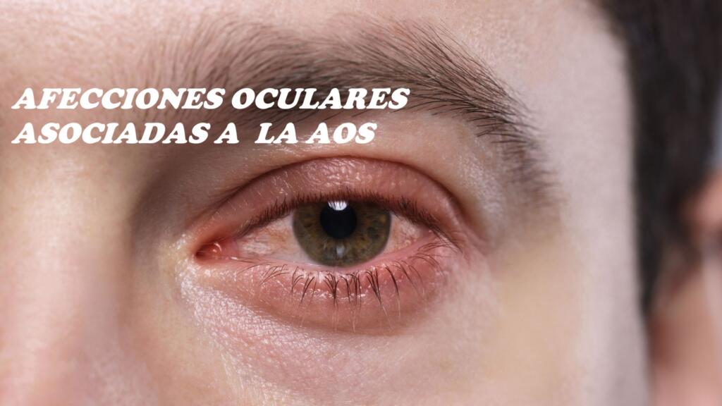 problemas oculares mas frecuentes sintomas y causas
