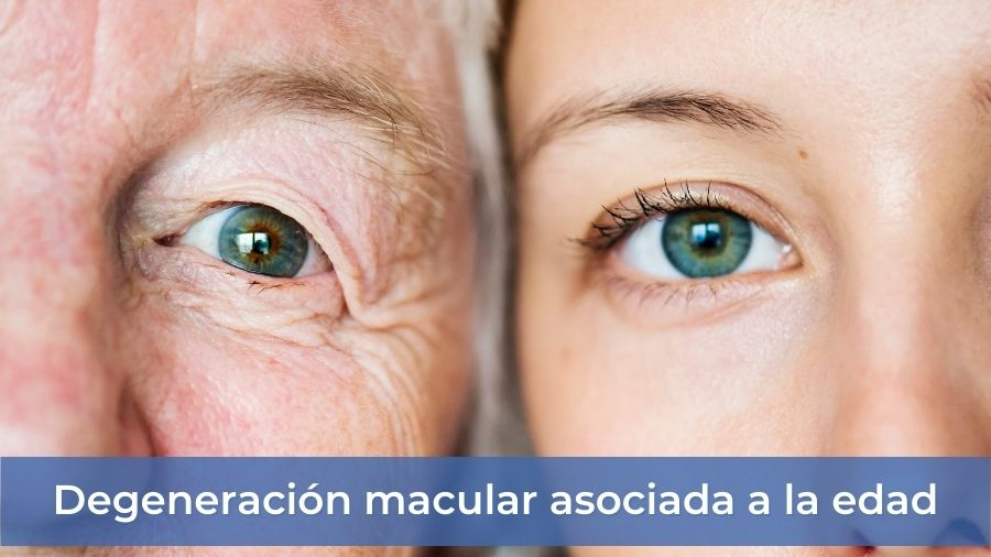 degeneracion macular asociada a la edad