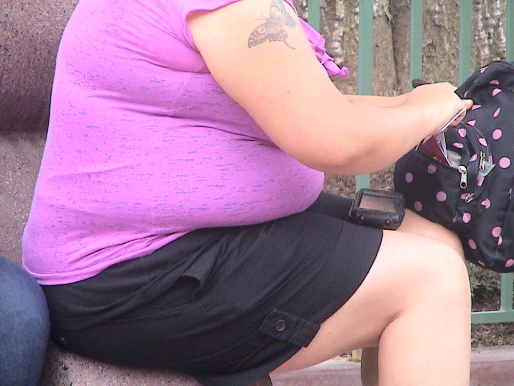 Obesidad en Mexico